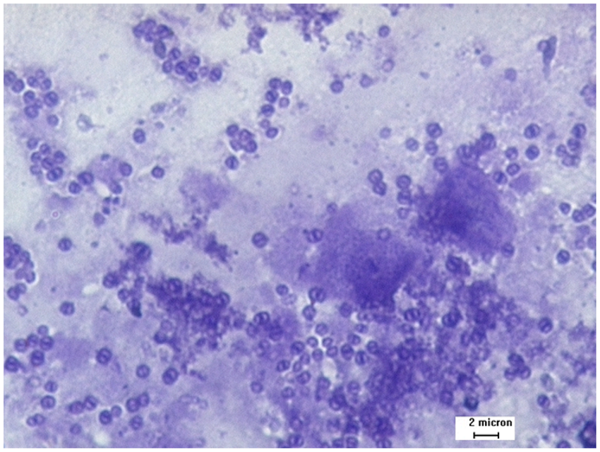 Ký sinh trùng microsporidia nhìn trên kính hiển vi