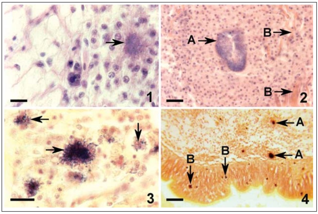 Vi khuẩn Nocardia crassostreae trên kính hiển vi